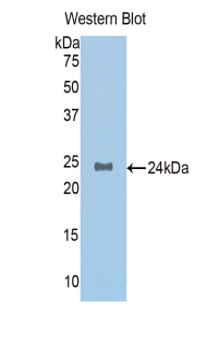 NAGA Antibody - Western blot of NAGA antibody.