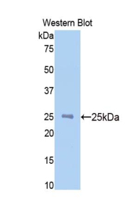 NAGA Antibody - Western blot of recombinant NAGA.  This image was taken for the unconjugated form of this product. Other forms have not been tested.