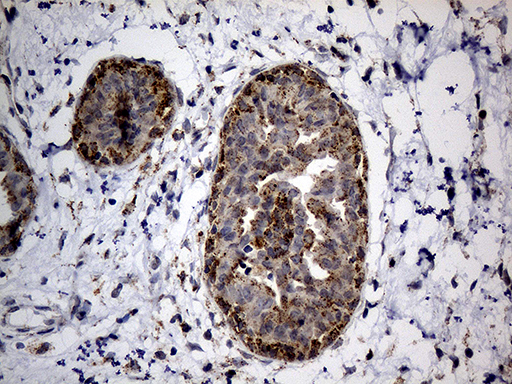 NAGA Antibody - Immunohistochemical staining of paraffin-embedded Human breast tissue within the normal limits using anti-NAGA mouse monoclonal antibody. (Heat-induced epitope retrieval by 1mM EDTA in 10mM Tris buffer. (pH8.5) at 120°C for 3 min. (1:500)