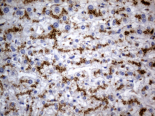 NAGA Antibody - Immunohistochemical staining of paraffin-embedded Human liver tissue within the normal limits using anti-NAGA mouse monoclonal antibody. (Heat-induced epitope retrieval by 1mM EDTA in 10mM Tris buffer. (pH8.5) at 120°C for 3 min. (1:500)