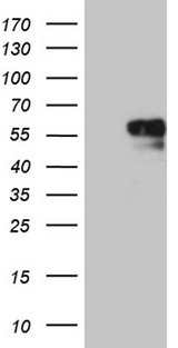 NAGA Antibody - HEK293T cells were transfected with the pCMV6-ENTRY control. (Left lane) or pCMV6-ENTRY NAGA. (Right lane) cDNA for 48 hrs and lysed. Equivalent amounts of cell lysates. (5 ug per lane) were separated by SDS-PAGE and immunoblotted with anti-NAGA. (1:2000)
