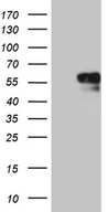NAGA Antibody - HEK293T cells were transfected with the pCMV6-ENTRY control. (Left lane) or pCMV6-ENTRY NAGA. (Right lane) cDNA for 48 hrs and lysed