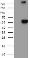 NAGA Antibody - HEK293T cells were transfected with the pCMV6-ENTRY control. (Left lane) or pCMV6-ENTRY NAGA. (Right lane) cDNA for 48 hrs and lysed