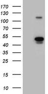 NAGA Antibody - HEK293T cells were transfected with the pCMV6-ENTRY control. (Left lane) or pCMV6-ENTRY NAGA. (Right lane) cDNA for 48 hrs and lysed. Equivalent amounts of cell lysates. (5 ug per lane) were separated by SDS-PAGE and immunoblotted with anti-NAGA. (1:2000)