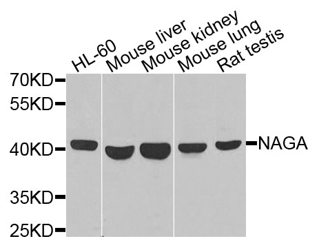 NAGA Antibody - Western blot analysis of extracts of various cells.