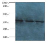 NAGK Antibody - Western blot. All lanes: N-acetyl-D-glucosamine kinase antibody at 2 ug/ml Lane 1:HepG2 whole cell lysate. Lane 2: 293T whole cell lysate Lane 3: HeLa whole cell lysate. Secondary antibody: Goat polyclonal to rabbit at 1:10000 dilution.  This image was taken for the unconjugated form of this product. Other forms have not been tested.