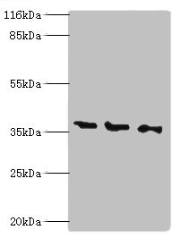 NAGK Antibody - Western blot All lanes: N-acetyl-D-glucosamine kinase antibody at 2µg/ml Lane 1: HepG2 whole cell lysate Lane 2: 293T whole cell lysate Lane 3: Hela whole cell lysate Secondary Goat polyclonal to rabbit IgG at 1/10000 dilution Predicted band size: 38, 43 kDa Observed band size: 38 kDa