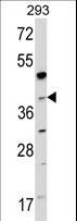 NAGK Antibody - Western blot of hNAGK-G315 (RB05452) in 293 cell line lysates (35 ug/lane). NAGK (arrow) was detected using the purified antibody.