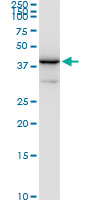 NAGK Antibody - NAGK monoclonal antibody (M05), clone 1H8. Western blot of NAGK expression in HepG2.