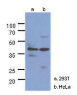 NAGK Antibody - Western Blot: The cell lysates (40 ug) were resolved by SDS-PAGE, transferred to PVDF membrane and probed with anti-human NAGK antibody (1:1000). Proteins were visualized using a goat anti-mouse secondary antibody conjugated to HRP and an ECL detection system.