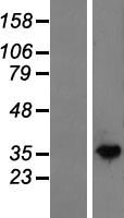 NAGK Protein - Western validation with an anti-DDK antibody * L: Control HEK293 lysate R: Over-expression lysate