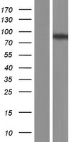 NAGLU Protein - Western validation with an anti-DDK antibody * L: Control HEK293 lysate R: Over-expression lysate