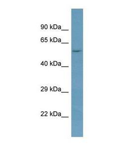 NAGPA Antibody - Western blot of Human OVCAR-3. NAGPA antibody dilution 1.0 ug/ml.  This image was taken for the unconjugated form of this product. Other forms have not been tested.