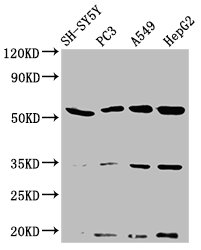 NAGPA Antibody - Western Blot Positive WB detected in: SH-SY5Y whole cell lysate, PC3 whole cell lysate, A549 whole cell lysate, HepG2 whole cell lysate All Lanes: NAGPA antibody at 3.2µg/ml Secondary Goat polyclonal to rabbit IgG at 1/50000 dilution Predicted band size: 57, 53, 34 KDa Observed band size: 57 KDa