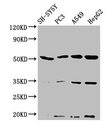 NAGPA Antibody - Western Blot Positive WB detected in: SH-SY5Y whole cell lysate, PC-3 whole cell lysate, A549 whole cell lysate, HepG2 whole cell lysate All lanes: NAGPA antibody at 3.2µg/ml Secondary Goat polyclonal to rabbit IgG at 1/50000 dilution Predicted band size: 57, 53, 34 kDa Observed band size: 53 kDa