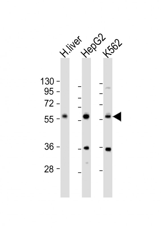 NAGS Antibody - All lanes: Anti-NAGS Antibody (Center) at 1:1000 dilution. Lane 1: human liver lysate. Lane 2: HepG2 whole cell lysate. Lane 3: K562 whole cell lysate Lysates/proteins at 20 ug per lane. Secondary Goat Anti-Rabbit IgG, (H+L), Peroxidase conjugated at 1:10000 dilution. Predicted band size: 58 kDa. Blocking/Dilution buffer: 5% NFDM/TBST.
