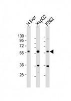 NAGS Antibody - All lanes: Anti-NAGS Antibody (Center) at 1:1000 dilution. Lane 1: human liver lysate. Lane 2: HepG2 whole cell lysate. Lane 3: K562 whole cell lysate Lysates/proteins at 20 ug per lane. Secondary Goat Anti-Rabbit IgG, (H+L), Peroxidase conjugated at 1:10000 dilution. Predicted band size: 58 kDa. Blocking/Dilution buffer: 5% NFDM/TBST.