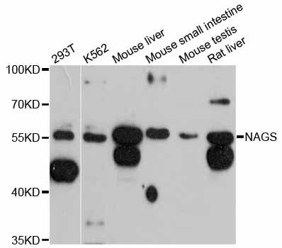 NAGS Antibody - Western blot analysis of extracts of various cell lines, using NAGS antibody at 1:3000 dilution. The secondary antibody used was an HRP Goat Anti-Rabbit IgG (H+L) at 1:10000 dilution. Lysates were loaded 25ug per lane and 3% nonfat dry milk in TBST was used for blocking. An ECL Kit was used for detection and the exposure time was 90s.
