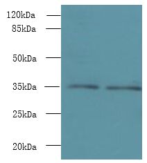 NAIF1 Antibody - Western blot. All lanes: NAIF1 antibody at 6 ug/ml. Lane 1: Mouse brain tissue. Lane 2: Mouse heart tissue. Secondary Goat polyclonal to Rabbit IgG at 1:10000 dilution. Predicted band size: 35 kDa. Observed band size: 35 kDa.