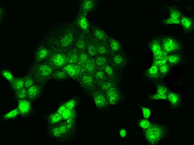 NAIF1 Antibody - Immunofluorescence staining of NAIF1 in A431 cells. Cells were fixed with 4% PFA, permeabilzed with 0.3% Triton X-100 in PBS, blocked with 10% serum, and incubated with rabbit anti-Human NAIF1 polyclonal antibody (dilution ratio 1:200) at 4°C overnight. Then cells were stained with the Alexa Fluor 488-conjugated Goat Anti-rabbit IgG secondary antibody (green) and counterstained with DAPI (blue). Positive staining was localized to Nucleus and Cytoplasm.