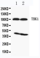 NAK / TBK1 Antibody - WB of NAK / TBK1 antibody. Lane 1: Rat Testis Tissue Lysate. Lane 2: Rat Liver Tissue Lysate.