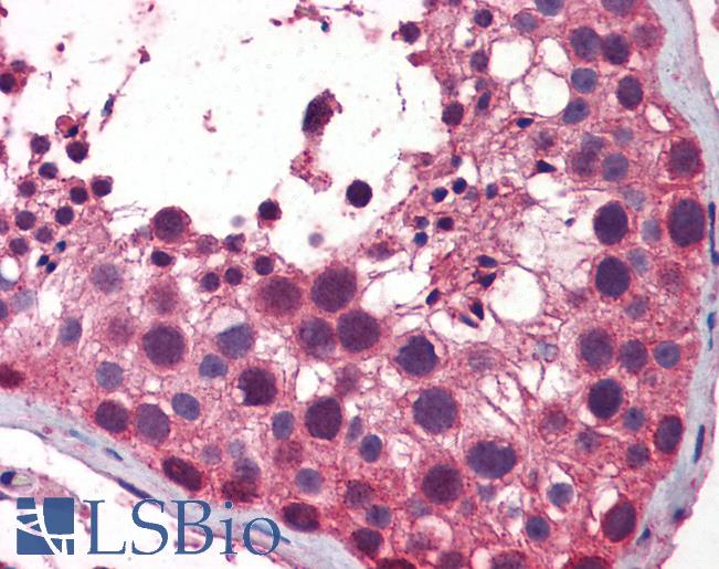 NAK / TBK1 Antibody - Anti-TBK1 antibody IHC of human testis. Immunohistochemistry of formalin-fixed, paraffin-embedded tissue after heat-induced antigen retrieval. Antibody concentration 5 ug/ml.  This image was taken for the unconjugated form of this product. Other forms have not been tested.