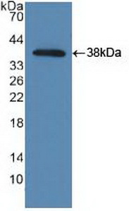 NAK / TBK1 Antibody - Western Blot; Sample: Recombinant TBK1, Human.