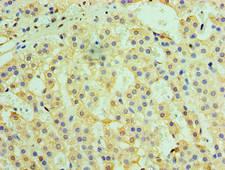 NAK / TBK1 Antibody - Immunohistochemistry of paraffin-embedded human adrenal gland tissue using TRAF6 Antibody at dilution of 1:100