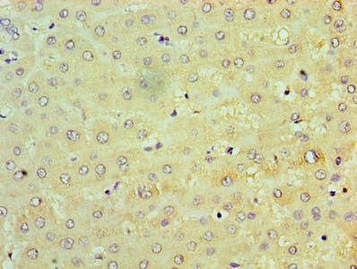 NAK / TBK1 Antibody - Immunohistochemistry of paraffin-embedded human liver tissue using TRAF6 Antibody at dilution of 1:100