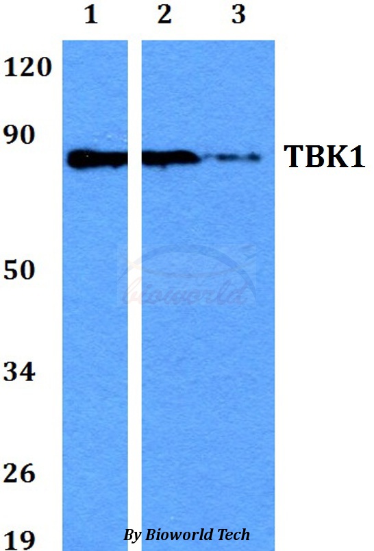 NAK / TBK1 Antibody - Western blot of TBK1 antibody at 1:500 dilution. Lane 1: HEK293T whole cell lysate. Lane 2: Raw264.7 whole cell lysate. Lane 3: PC12 whole cell lysate.
