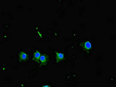 NAK / TBK1 Antibody - Immunofluorescent analysis of HeLa cells diluted at 1:100 and Alexa Fluor 488-congugated AffiniPure Goat Anti-Rabbit IgG(H+L)