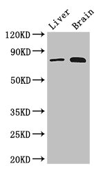 NAK / TBK1 Antibody - Western Blot Positive WB detected in:Mouse liver tissue,Mouse brain tissue All Lanes: TBK1 antibody at 3ug/ml Secondary Goat polyclonal to rabbit IgG at 1/50000 dilution Predicted band size: 84 kDa Observed band size: 84 kDa