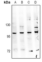 NAK / TBK1 Antibody - Western blot analysis of TBK1 expression in mouse testis (A), rat testis (B), U87MG (C), A549 (D) whole cell lysates.