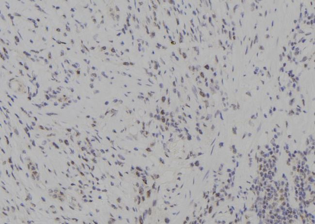 NAK / TBK1 Antibody - 1:100 staining human gastric tissue by IHC-P. The sample was formaldehyde fixed and a heat mediated antigen retrieval step in citrate buffer was performed. The sample was then blocked and incubated with the antibody for 1.5 hours at 22°C. An HRP conjugated goat anti-rabbit antibody was used as the secondary.
