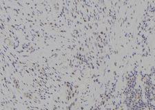 NAK / TBK1 Antibody - 1:100 staining human gastric tissue by IHC-P. The sample was formaldehyde fixed and a heat mediated antigen retrieval step in citrate buffer was performed. The sample was then blocked and incubated with the antibody for 1.5 hours at 22°C. An HRP conjugated goat anti-rabbit antibody was used as the secondary.