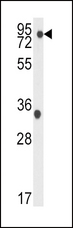 NAK / TBK1 Antibody - Western blot of anti-TBK Antibody (S172) in K562 cell line lysates (35 ug/lane). TBK1(arrow) was detected using the purified antibody.