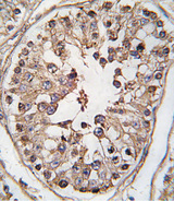 NAK / TBK1 Antibody - Formalin-fixed and paraffin-embedded human testis tissue reacted with TBK-pS172, which was peroxidase-conjugated to the secondary antibody, followed by DAB staining. This data demonstrates the use of this antibody for immunohistochemistry; clinical relevance has not been evaluated.