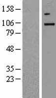 NAK / TBK1 Protein - Western validation with an anti-DDK antibody * L: Control HEK293 lysate R: Over-expression lysate