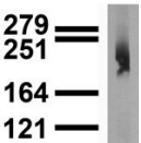 NALCN Antibody - Immunoblot of #11568 on adult rat brain lysate.