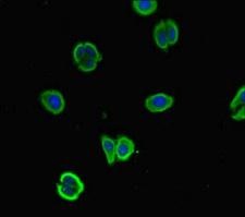 NALCN Antibody - Immunofluorescent analysis of HepG-2 cells diluted at 1:100 and Alexa Fluor 488-congugated AffiniPure Goat Anti-Rabbit IgG(H+L)