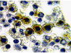 NALP1 / NLRP1 Antibody - Formalin-fixed, paraffin-embedded normal human bone marrow stained for NALP1 (CARD7/NAP) using NALP1 antibody at 1:2000. Hematoxylin-Eosin counterstain. Staining is seen in differentiated granulocytes.
