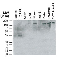 NALP1 / NLRP1 Antibody - Western blot of NLRP1 in adult human tissue lysates using NLRP1 antibody at 1:2000. Full-length NLRP1 protein was detected at highest levels in kidney, brain and epidermis. A smaller band was detected in thymus, possibly representing a NLRP1 breakdown product or alternatively spliced form. 293T/NALP1: positive control, 293T cells transiently transfected with full-length NLRP1.
