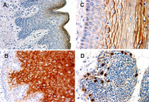 NALP1 / NLRP1 Antibody - Formalin-fixed, paraffin-embedded normal human tissue sections probed using NLRP1 antibody at 1:2000. A, epidermis. B, esophagus. C, uterine cervix. D, thymus. Hematoxylin-Eosin counterstain. In A-C, NLRP1 expression is associated with differentiation in stratified epithelial of the skin, esophagus, and cervix.