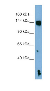 NALP1 / NLRP1 Antibody - NLRP1 / NALP1 antibody Western blot of NCI-H226 cell lysate. This image was taken for the unconjugated form of this product. Other forms have not been tested.