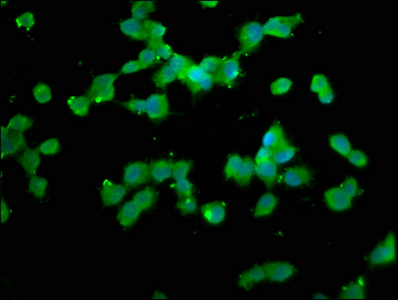 NALP1 / NLRP1 Antibody - Immunofluorescence staining of SH-SY5Y cells with NLRP1 Antibody at 1:133, counter-stained with DAPI. The cells were fixed in 4% formaldehyde, permeabilized using 0.2% Triton X-100 and blocked in 10% normal Goat Serum. The cells were then incubated with the antibody overnight at 4°C. The secondary antibody was Alexa Fluor 488-congugated AffiniPure Goat Anti-Rabbit IgG(H+L).