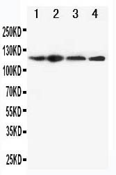 NALP3 / NLRP3 Antibody - WB of NALP3 / NLRP3 antibody. All lanes: Anti-NLRP3 at 0.5ug/ml. Lane 1: HEP-2 Whole Cell Lysate at 40ug. Lane 2: A549 Whole Cell Lysate at 40ug. Lane 3: U87 Whole Cell Lysate at 40ug. Lane 4: CEM Whole Cell Lysate at 40ug. Predicted bind size: 118KD. Observed bind size: 118KD.