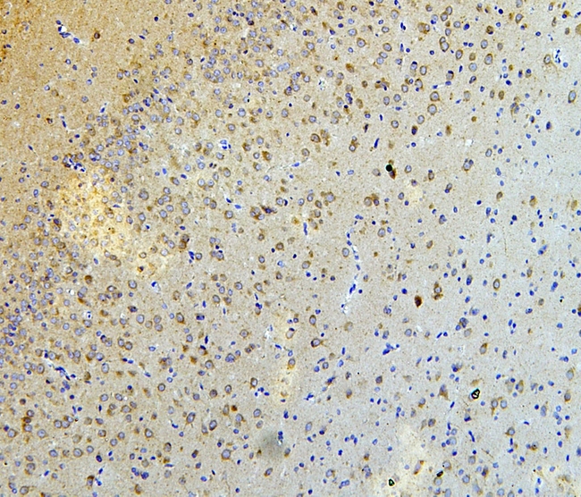 NALP3 / NLRP3 Antibody - IHC analysis of NLRP3 using anti-NLRP3 antibody. NLRP3 was detected in paraffin-embedded section of rat brain tissues. Heat mediated antigen retrieval was performed in citrate buffer (pH6, epitope retrieval solution) for 20 mins. The tissue section was blocked with 10% goat serum. The tissue section was then incubated with 1µg/ml rabbit anti-NLRP3 Antibody overnight at 4°C. Biotinylated goat anti-rabbit IgG was used as secondary antibody and incubated for 30 minutes at 37°C. The tissue section was developed using Strepavidin-Biotin-Complex (SABC) with DAB as the chromogen.