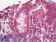 NALP3 / NLRP3 Antibody - Anti-NALP3 / NLRP3 antibody IHC of human colon, epithelium. Immunohistochemistry of formalin-fixed, paraffin-embedded tissue after heat-induced antigen retrieval. Antibody dilution 5-10 ug/ml. This image was taken for the unconjugated form of this product. Other forms have not been tested.