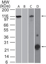 NALP3 / NLRP3 Antibody - Western Blot: NALP3 Antibody (25N10E9) - Analysis using the NALP3 monoclonal antibody. (A), (B), mouse RAW lysate and the recombinant mouse NLRP3 NOD domain protein immunogen (D) probed with 2 ug/ml antibody. goat anti-mouse Ig HRP secondary antibody and PicoTect ECL substrate solution were used for this test.  This image was taken for the unconjugated form of this product. Other forms have not been tested.