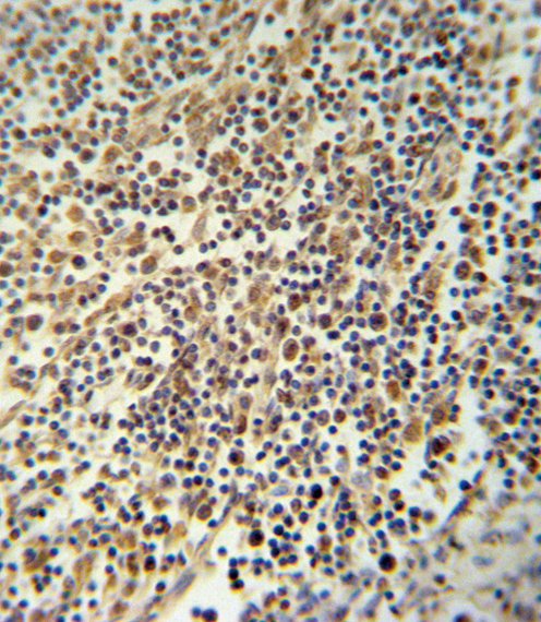 NALP3 / NLRP3 Antibody - NLRP3 Antibody immunohistochemistry of formalin-fixed and paraffin-embedded human lymph tissue followed by peroxidase-conjugated secondary antibody and DAB staining.